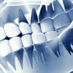 ฟันปลอมอัจฉริยะ “เชื่อมสมอง” ได้จริง นักวิทย์พัฒนาเทคโนโลยีรากฟันเทียมที่รู้สึกได้เหมือนฟันจริง