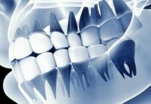 ฟันปลอมอัจฉริยะ “เชื่อมสมอง” ได้จริง นักวิทย์พัฒนาเทคโนโลยีรากฟันเทียมที่รู้สึกได้เหมือนฟันจริง