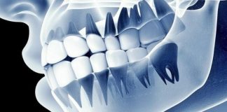 ฟันปลอมอัจฉริยะ “เชื่อมสมอง” ได้จริง นักวิทย์พัฒนาเทคโนโลยีรากฟันเทียมที่รู้สึกได้เหมือนฟันจริง