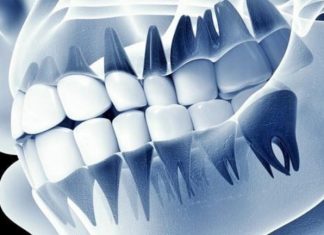 ฟันปลอมอัจฉริยะ “เชื่อมสมอง” ได้จริง นักวิทย์พัฒนาเทคโนโลยีรากฟันเทียมที่รู้สึกได้เหมือนฟันจริง