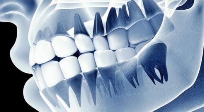 ฟันปลอมอัจฉริยะ “เชื่อมสมอง” ได้จริง นักวิทย์พัฒนาเทคโนโลยีรากฟันเทียมที่รู้สึกได้เหมือนฟันจริง