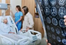 อัลไซเมอร์อาจไม่ใช่โรคทางสมอง แต่เป็นโรคภูมิคุ้มกันทำลายตัวเอง