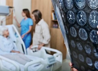 อัลไซเมอร์อาจไม่ใช่โรคทางสมอง แต่เป็นโรคภูมิคุ้มกันทำลายตัวเอง