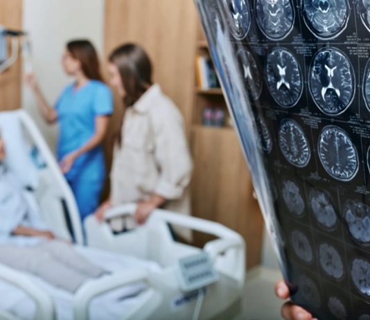 อัลไซเมอร์อาจไม่ใช่โรคทางสมอง แต่เป็นโรคภูมิคุ้มกันทำลายตัวเอง