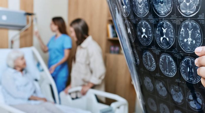 อัลไซเมอร์อาจไม่ใช่โรคทางสมอง แต่เป็นโรคภูมิคุ้มกันทำลายตัวเอง