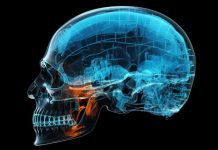 โรคเหงือก ตัวการเงียบ อาจเชื่อมโยงโรคอัลไซเมอร์ เสี่ยงสมองเสื่อมโดยไม่รู้ตัว