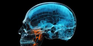 โรคเหงือก ตัวการเงียบ อาจเชื่อมโยงโรคอัลไซเมอร์ เสี่ยงสมองเสื่อมโดยไม่รู้ตัว