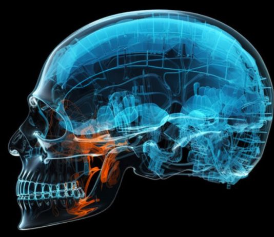 โรคเหงือก ตัวการเงียบ อาจเชื่อมโยงโรคอัลไซเมอร์ เสี่ยงสมองเสื่อมโดยไม่รู้ตัว