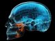 โรคเหงือก ตัวการเงียบ อาจเชื่อมโยงโรคอัลไซเมอร์ เสี่ยงสมองเสื่อมโดยไม่รู้ตัว