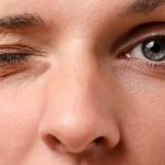 หยุดความเชื่อเรื่องลางร้าย ตากระตุกบ่อยอาจสัญญาณโรคจากสมอง Hemifacial Spasm: โรคใบหน้ากระตุกที่คุณอาจไม่รู้ว่ากำลังเป็น