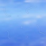 จุดลอยในตา (Eye Floaters) สัญญาณเตือนอันตรายไม่ควรมองข้าม สิ่งที่ควรรู้เพื่อป้องกันภาวะแทรกซ้อน