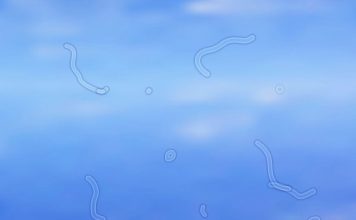 จุดลอยในตา (Eye Floaters) สัญญาณเตือนอันตรายไม่ควรมองข้าม สิ่งที่ควรรู้เพื่อป้องกันภาวะแทรกซ้อน