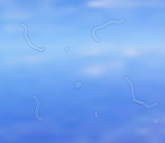 จุดลอยในตา (Eye Floaters) สัญญาณเตือนอันตรายไม่ควรมองข้าม สิ่งที่ควรรู้เพื่อป้องกันภาวะแทรกซ้อน