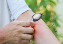 เคล็ดลับหน้าฝน ลดบวม ลดคันจากยุงกัดแบบปลอดภัย ด้วยใช้ช้อนอุ่นนาบจุดที่ยุงกัด