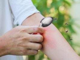 เคล็ดลับหน้าฝน ลดบวม ลดคันจากยุงกัดแบบปลอดภัย ด้วยใช้ช้อนอุ่นนาบจุดที่ยุงกัด