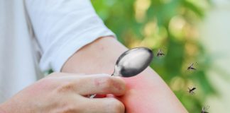 เคล็ดลับหน้าฝน ลดบวม ลดคันจากยุงกัดแบบปลอดภัย ด้วยใช้ช้อนอุ่นนาบจุดที่ยุงกัด