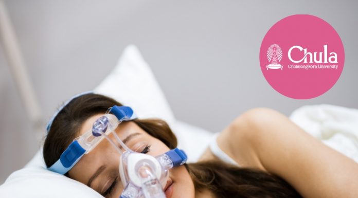 จุฬาฯ ผ่าตัดรักษาโรคหยุดหายใจขณะหลับ ด้วยเทคนิค HGNS สำเร็จครั้งแรกในไทย ศูนย์นิทราเวช จุฬาฯ ช่วยผู้ป่วยหลับดี แห่งที่ 4 ของเอเชีย