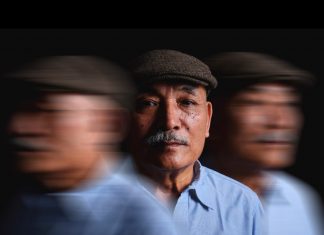 Alzheimers กับ Dementia โรคทางสมองที่พรากความทรงจำและชีวิตคนดัง ความต่างของโรคเงียบที่ต้องเฝ้าระวังและแพทย์เร่งหาวิธีรักษา