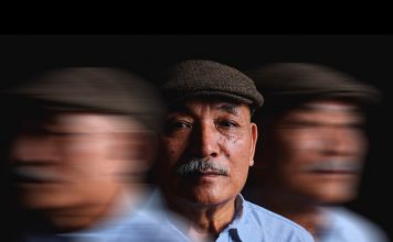 Alzheimers กับ Dementia โรคทางสมองที่พรากความทรงจำและชีวิตคนดัง ความต่างของโรคเงียบที่ต้องเฝ้าระวังและแพทย์เร่งหาวิธีรักษา