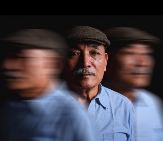 Alzheimers กับ Dementia โรคทางสมองที่พรากความทรงจำและชีวิตคนดัง ความต่างของโรคเงียบที่ต้องเฝ้าระวังและแพทย์เร่งหาวิธีรักษา